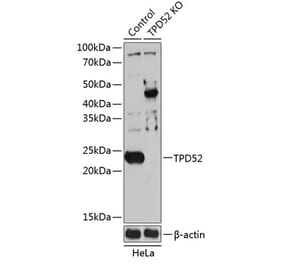 Western Blot - Anti-TPD52 Antibody (A307165) - Antibodies.com