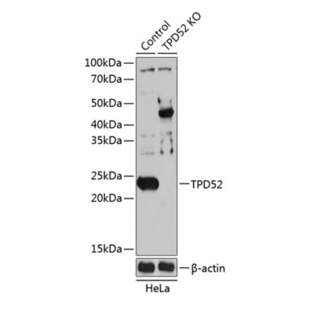 Western Blot - Anti-TPD52 Antibody (A307165) - Antibodies.com