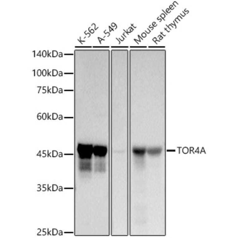 Western Blot - Anti-C9orf167 Antibody [ARC2939] (A307166) - Antibodies.com