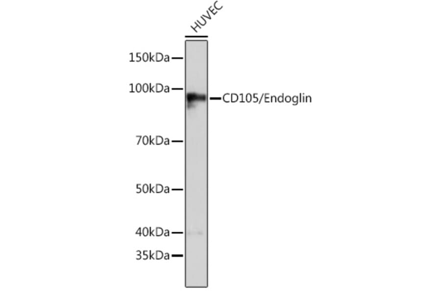 Western Blot - Anti-CD105 Antibody [ARC0446] (A307167) - Antibodies.com