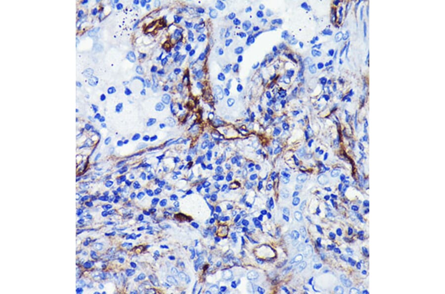 Immunohistochemistry - Anti-CD105 Antibody [ARC0446] (A307167) - Antibodies.com