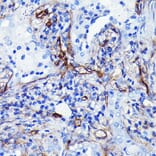 Immunohistochemistry - Anti-CD105 Antibody [ARC0446] (A307167) - Antibodies.com