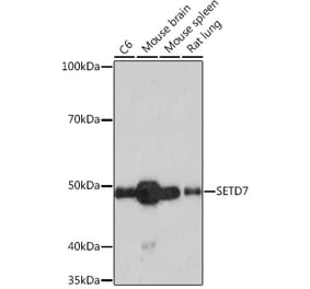 Western Blot - Anti-SET7 Antibody [ARC1483] (A307168) - Antibodies.com