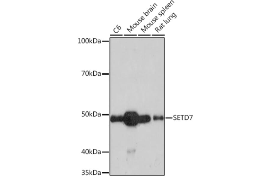 Western Blot - Anti-SET7 Antibody [ARC1483] (A307168) - Antibodies.com
