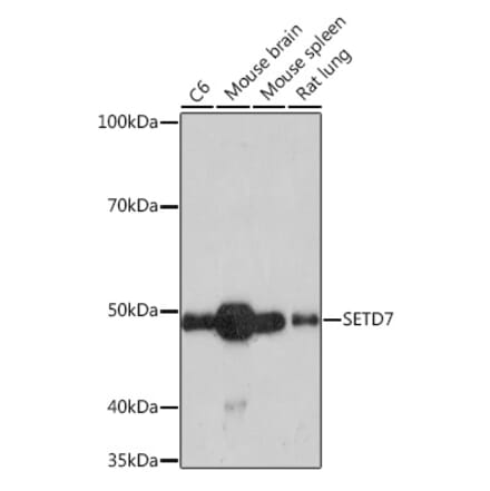 Western Blot - Anti-SET7 Antibody [ARC1483] (A307168) - Antibodies.com