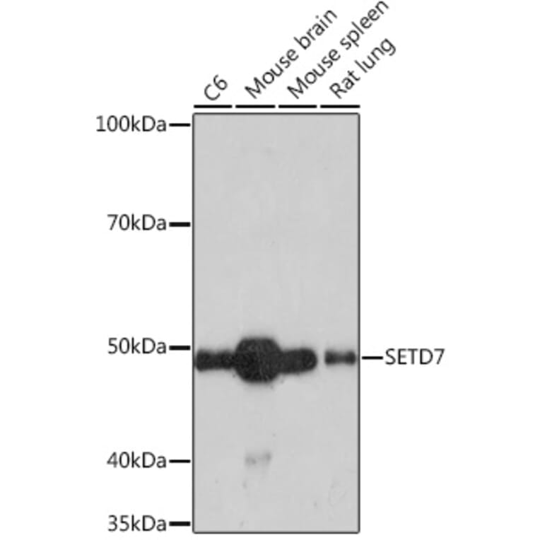 Western Blot - Anti-SET7 Antibody [ARC1483] (A307168) - Antibodies.com