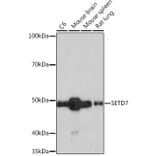 Western Blot - Anti-SET7 Antibody [ARC1483] (A307168) - Antibodies.com