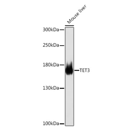Western Blot - Anti-TET3 Antibody (A307169) - Antibodies.com