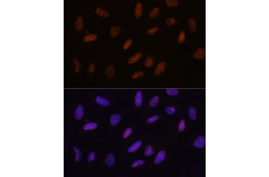 Immunofluorescence - Anti-TET3 Antibody (A307169) - Antibodies.com