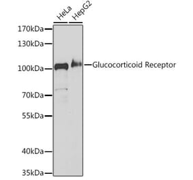 Western Blot - Anti-Glucocorticoid Receptor Antibody (A307170) - Antibodies.com