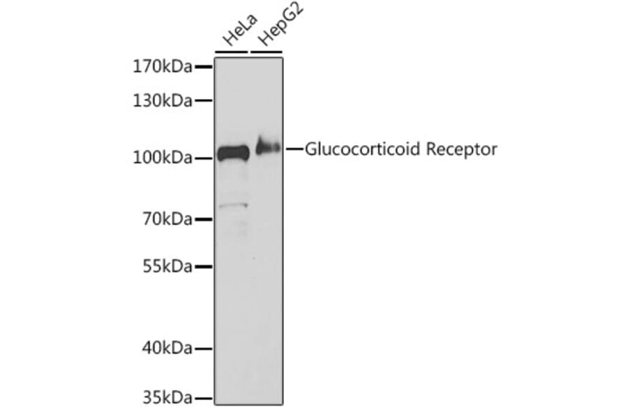 Western Blot - Anti-Glucocorticoid Receptor Antibody (A307170) - Antibodies.com