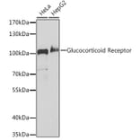 Western Blot - Anti-Glucocorticoid Receptor Antibody (A307170) - Antibodies.com