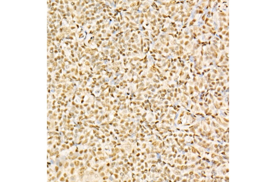 Immunohistochemistry - Anti-Glucocorticoid Receptor Antibody (A307170) - Antibodies.com