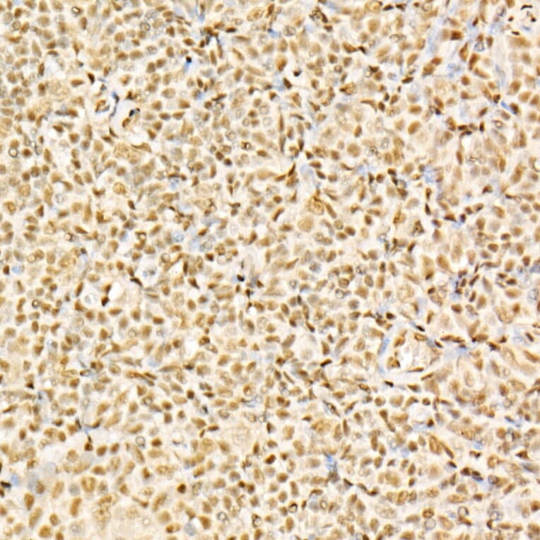 Immunohistochemistry - Anti-Glucocorticoid Receptor Antibody (A307170) - Antibodies.com