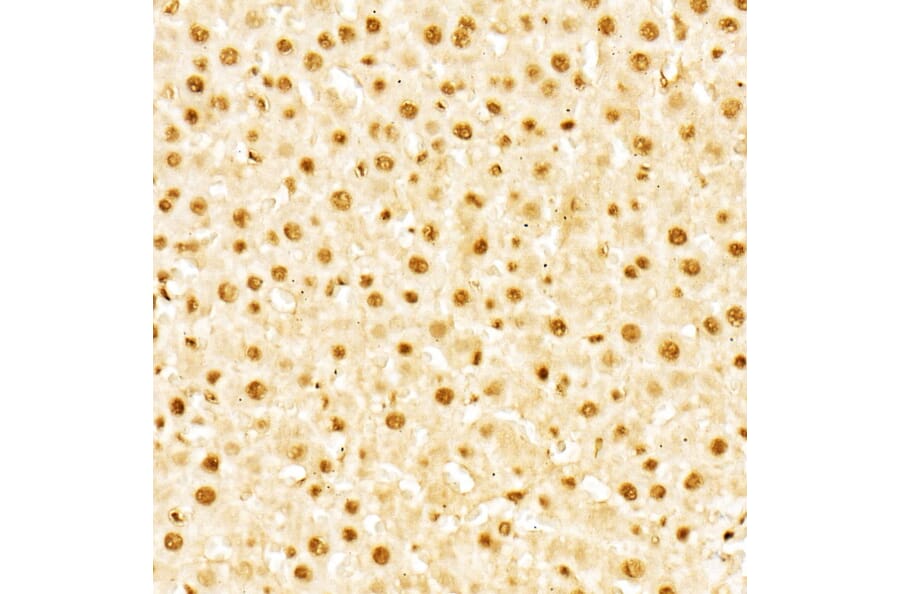 Immunohistochemistry - Anti-Glucocorticoid Receptor Antibody (A307170) - Antibodies.com