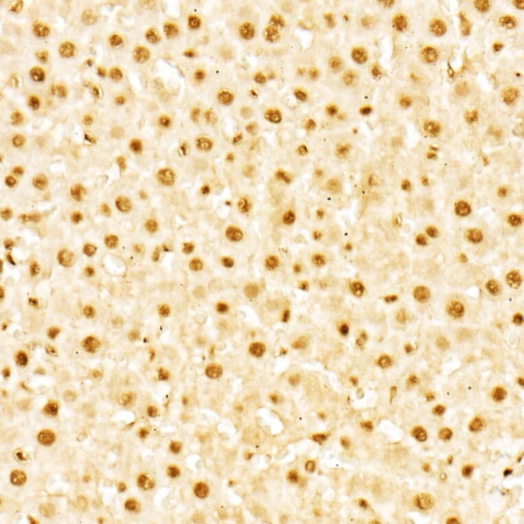 Immunohistochemistry - Anti-Glucocorticoid Receptor Antibody (A307170) - Antibodies.com