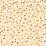 Immunohistochemistry - Anti-Glucocorticoid Receptor Antibody (A307170) - Antibodies.com