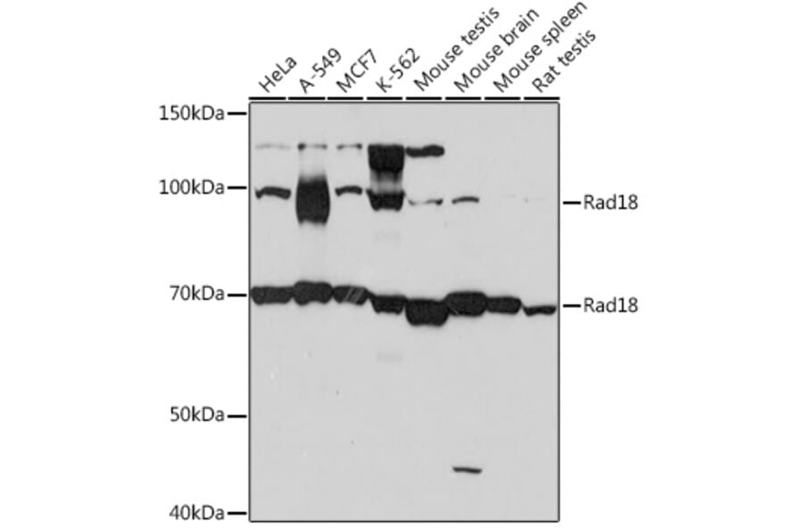 Western Blot - Anti-RAD18 Antibody [ARC1058] (A307171) - Antibodies.com