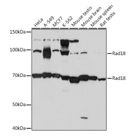 Western Blot - Anti-RAD18 Antibody [ARC1058] (A307171) - Antibodies.com