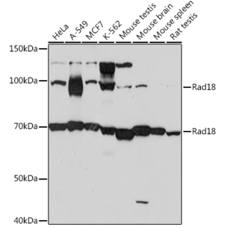 Western Blot - Anti-RAD18 Antibody [ARC1058] (A307171) - Antibodies.com