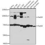 Western Blot - Anti-RAD18 Antibody [ARC1058] (A307171) - Antibodies.com