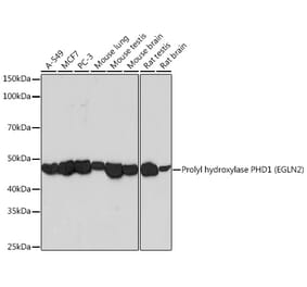 Western Blot - Anti-PHD1/prolyl hydroxylase Antibody [ARC0230] (A307172) - Antibodies.com