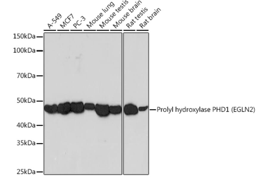 Western Blot - Anti-PHD1/prolyl hydroxylase Antibody [ARC0230] (A307172) - Antibodies.com