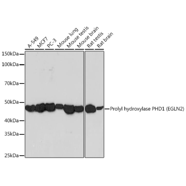 Western Blot - Anti-PHD1/prolyl hydroxylase Antibody [ARC0230] (A307172) - Antibodies.com