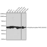 Western Blot - Anti-PHD1/prolyl hydroxylase Antibody [ARC0230] (A307172) - Antibodies.com