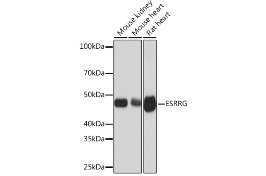 Western Blot - Anti-Estrogen Related Receptor gamma Antibody [ARC1653] (A307173) - Antibodies.com