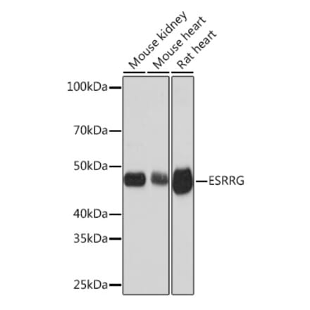 Western Blot - Anti-Estrogen Related Receptor gamma Antibody [ARC1653] (A307173) - Antibodies.com