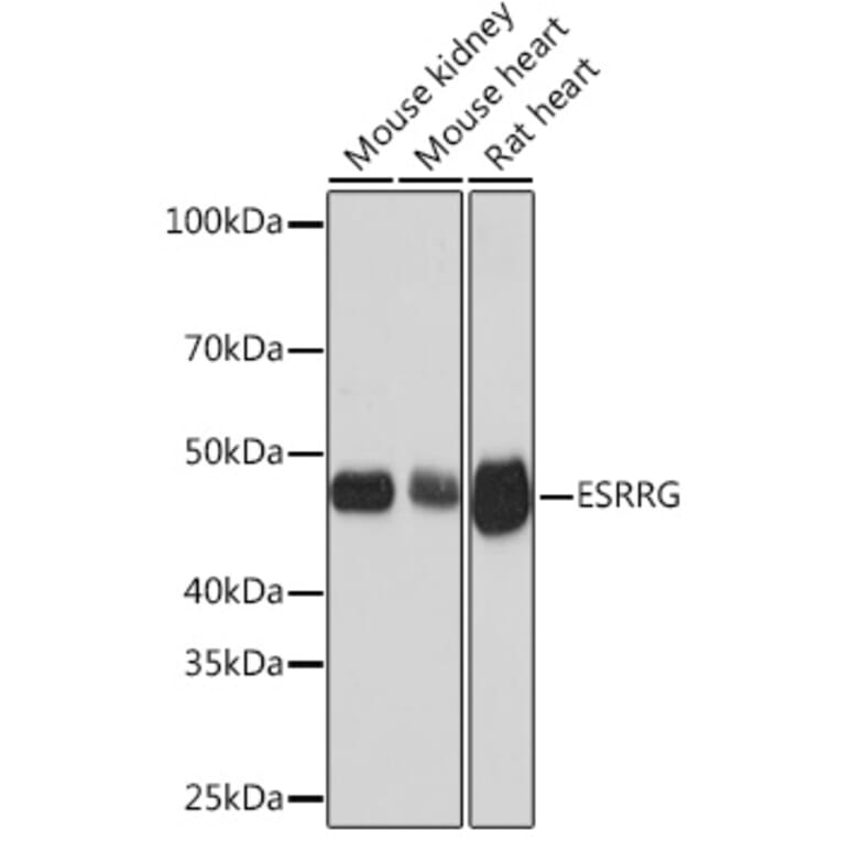 Western Blot - Anti-Estrogen Related Receptor gamma Antibody [ARC1653] (A307173) - Antibodies.com