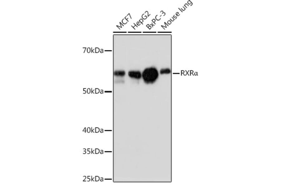 Western Blot - Anti-Retinoid X Receptor alpha/RXRA Antibody [ARC0468] (A307174) - Antibodies.com