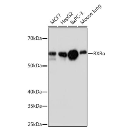 Western Blot - Anti-Retinoid X Receptor alpha/RXRA Antibody [ARC0468] (A307174) - Antibodies.com