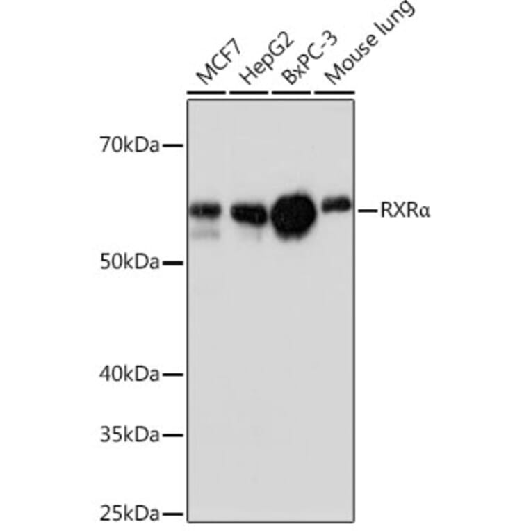 Western Blot - Anti-Retinoid X Receptor alpha / RXRA Antibody [ARC0468] (A307174) - Antibodies.com