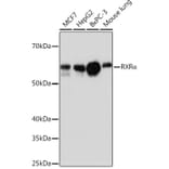 Western Blot - Anti-Retinoid X Receptor alpha / RXRA Antibody [ARC0468] (A307174) - Antibodies.com