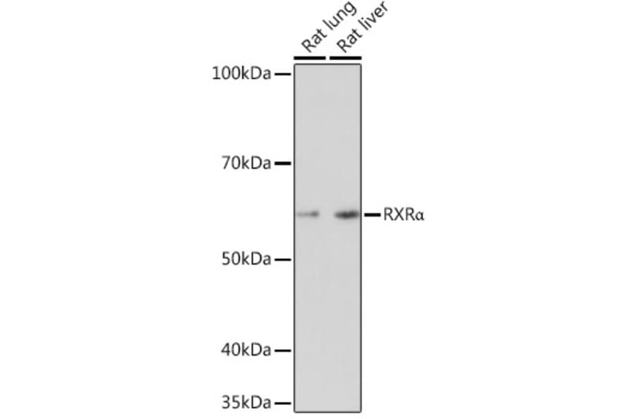 Western Blot - Anti-Retinoid X Receptor alpha/RXRA Antibody [ARC0468] (A307174) - Antibodies.com