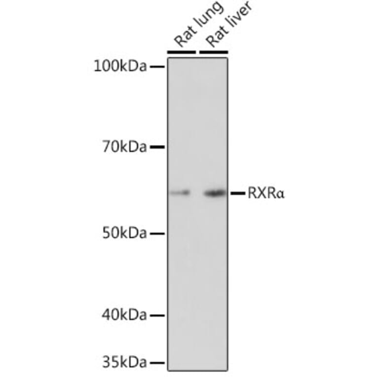 Western Blot - Anti-Retinoid X Receptor alpha / RXRA Antibody [ARC0468] (A307174) - Antibodies.com