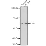 Western Blot - Anti-Retinoid X Receptor alpha / RXRA Antibody [ARC0468] (A307174) - Antibodies.com