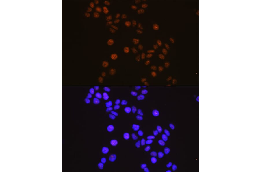 Immunofluorescence - Anti-Retinoid X Receptor alpha/RXRA Antibody [ARC0468] (A307174) - Antibodies.com