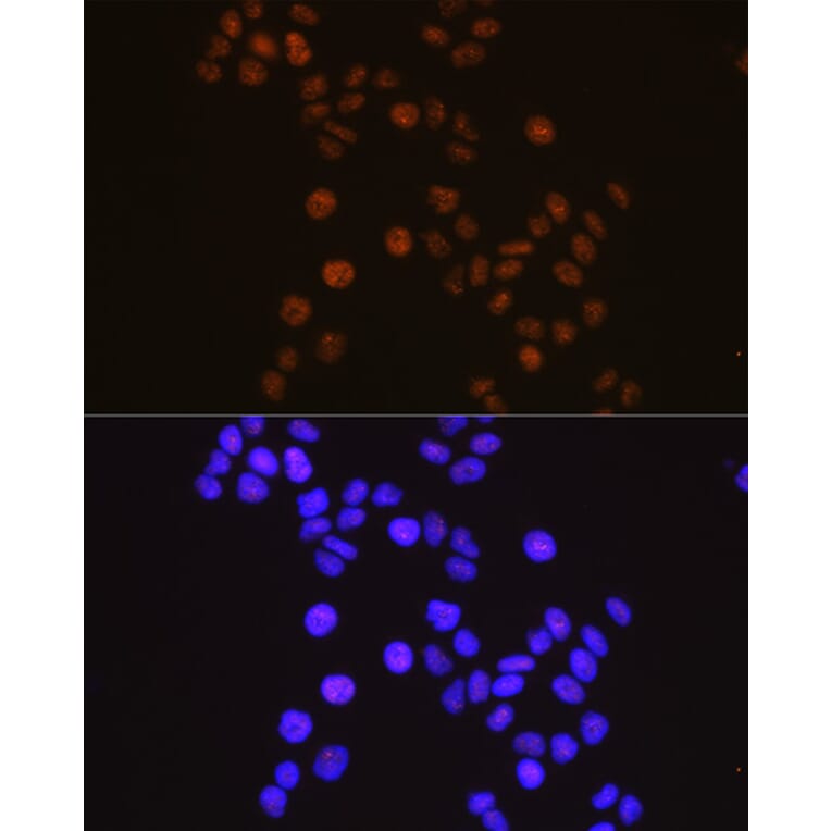 Immunofluorescence - Anti-Retinoid X Receptor alpha / RXRA Antibody [ARC0468] (A307174) - Antibodies.com