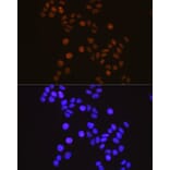 Immunofluorescence - Anti-Retinoid X Receptor alpha / RXRA Antibody [ARC0468] (A307174) - Antibodies.com