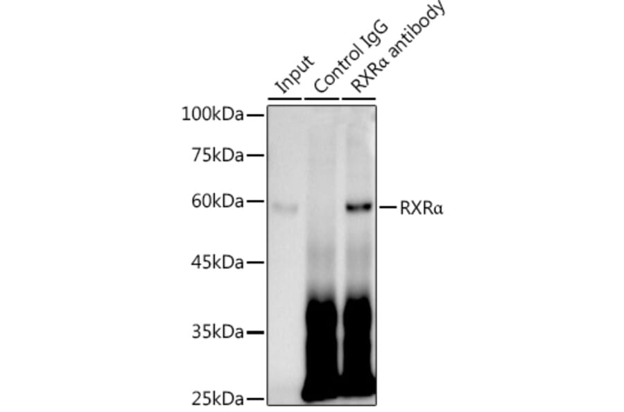 Western Blot - Anti-Retinoid X Receptor alpha/RXRA Antibody [ARC0468] (A307174) - Antibodies.com