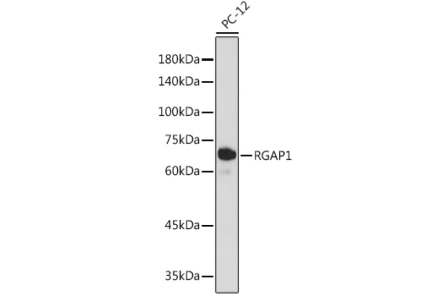 Western Blot - Anti-RACGAP1/MGCRACGAP Antibody [ARC2394] (A307175) - Antibodies.com
