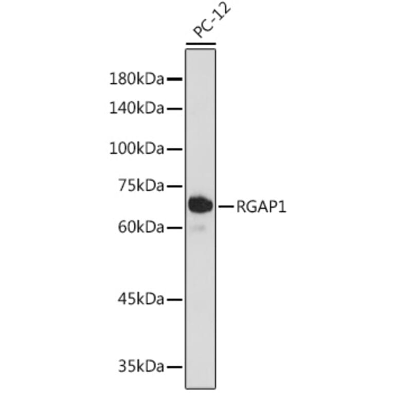Western Blot - Anti-RACGAP1/MGCRACGAP Antibody [ARC2394] (A307175) - Antibodies.com