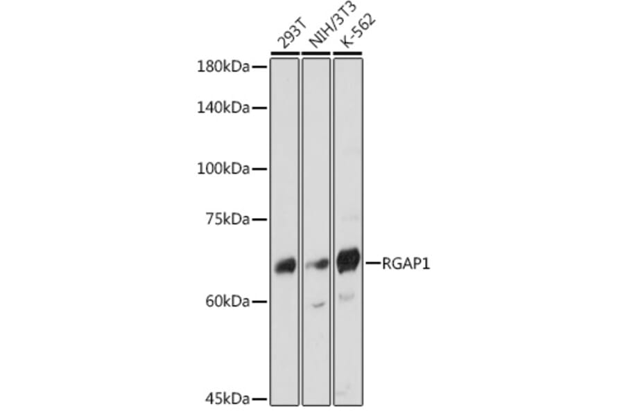 Western Blot - Anti-RACGAP1/MGCRACGAP Antibody [ARC2394] (A307175) - Antibodies.com