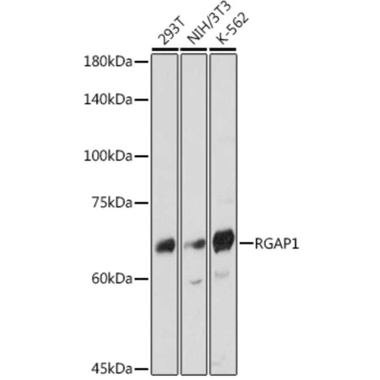 Western Blot - Anti-RACGAP1/MGCRACGAP Antibody [ARC2394] (A307175) - Antibodies.com