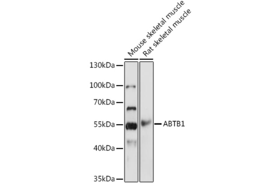 Western Blot - Anti-BPOZ/ABTB1 Antibody (A307176) - Antibodies.com