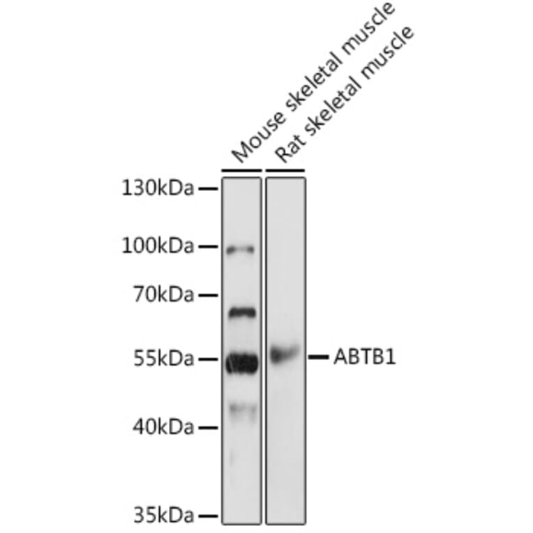 Western Blot - Anti-BPOZ/ABTB1 Antibody (A307176) - Antibodies.com