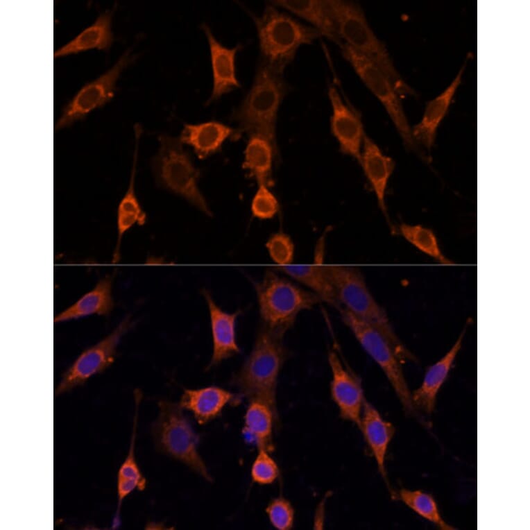 Immunofluorescence - Anti-PDCD4 Antibody (A307178) - Antibodies.com